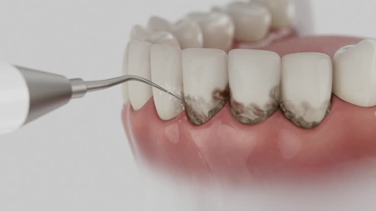Reliable Teeth Cleaning And Checkup contractor in Madison County County, IA by Dentist Open Now